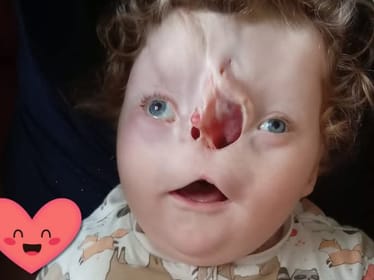 Maksiu Czerniak - main photo