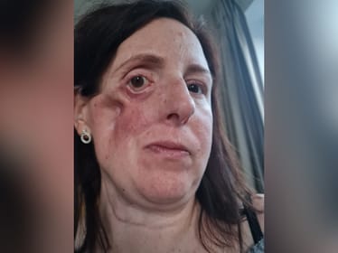 Marta Młyńska - zdjęcie główne