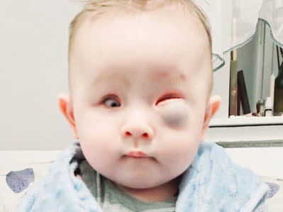 Luka Dmytriv - main photo