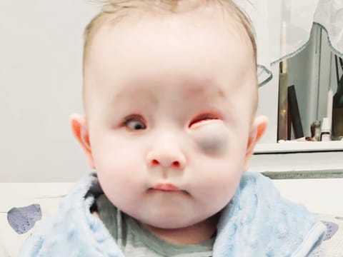 Luka Dmytriv - main photo