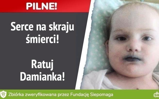 Skarbonki Fundacji DOBROWRACA MG