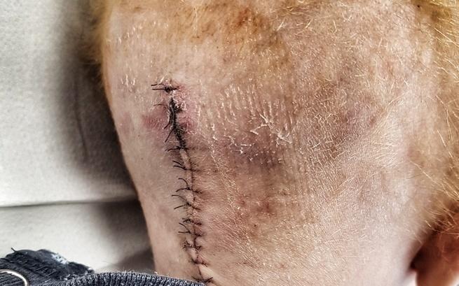 Skarbonki Fundacji DOBROWRACA MG