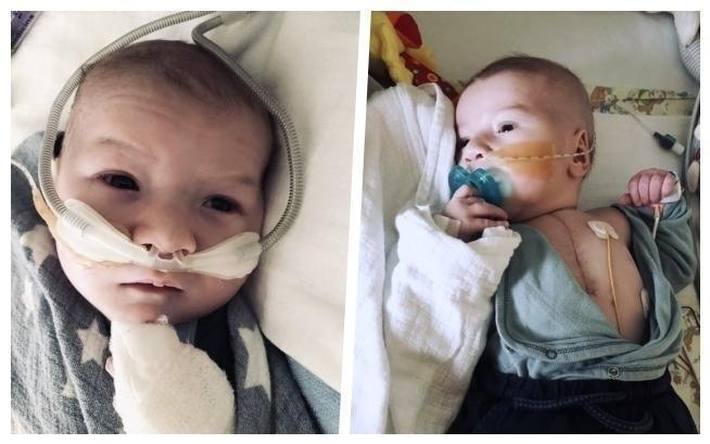 Skarbonki Fundacji DOBROWRACA MG