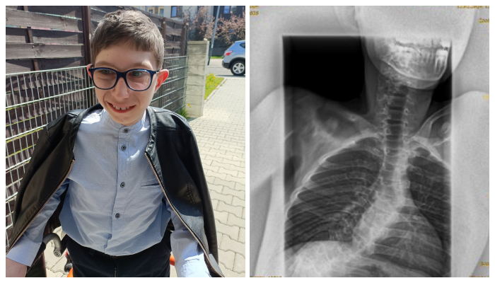 Maksymilian Szendera