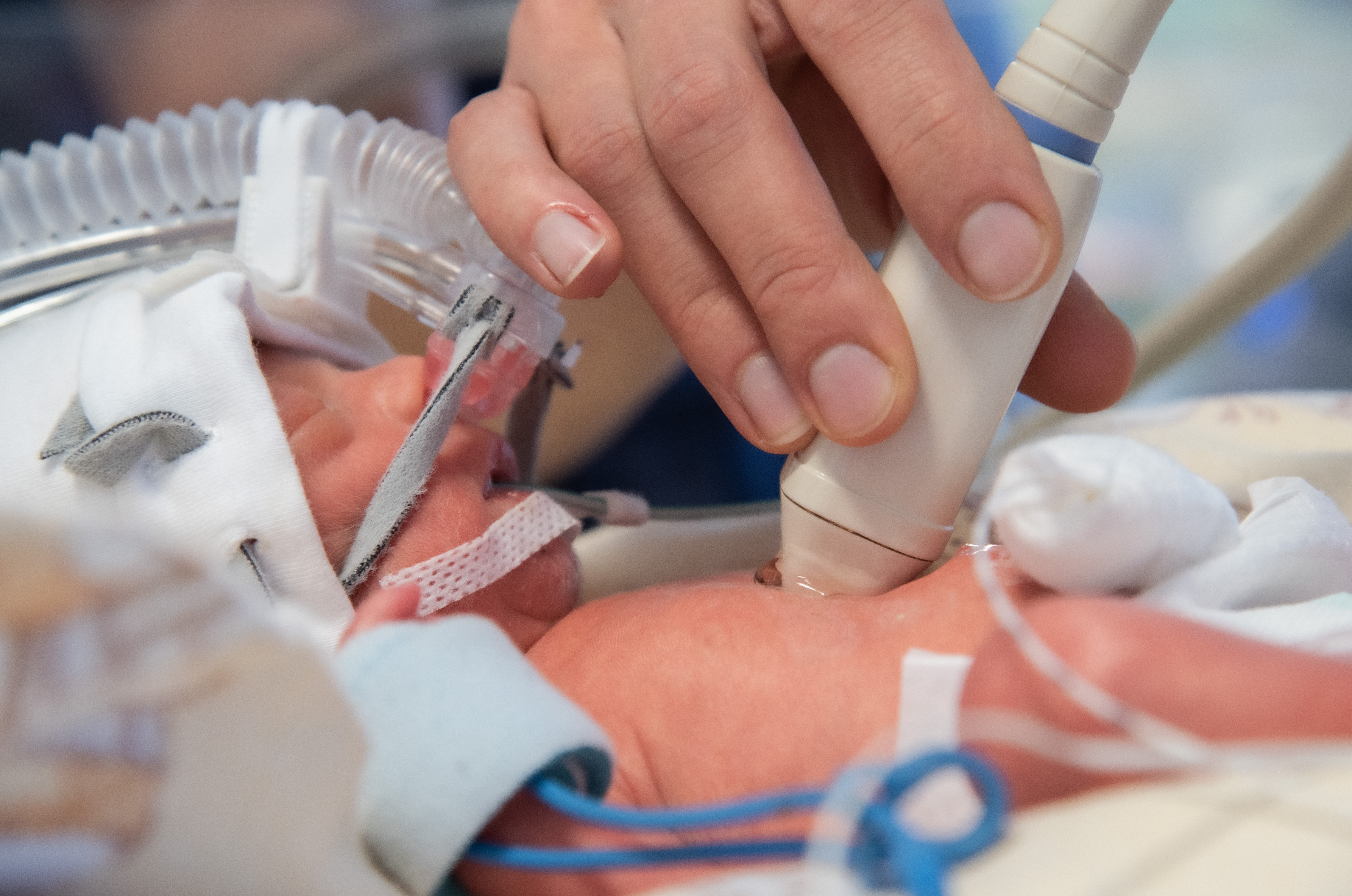 Ratujemy Małopolskie Wcześniaki