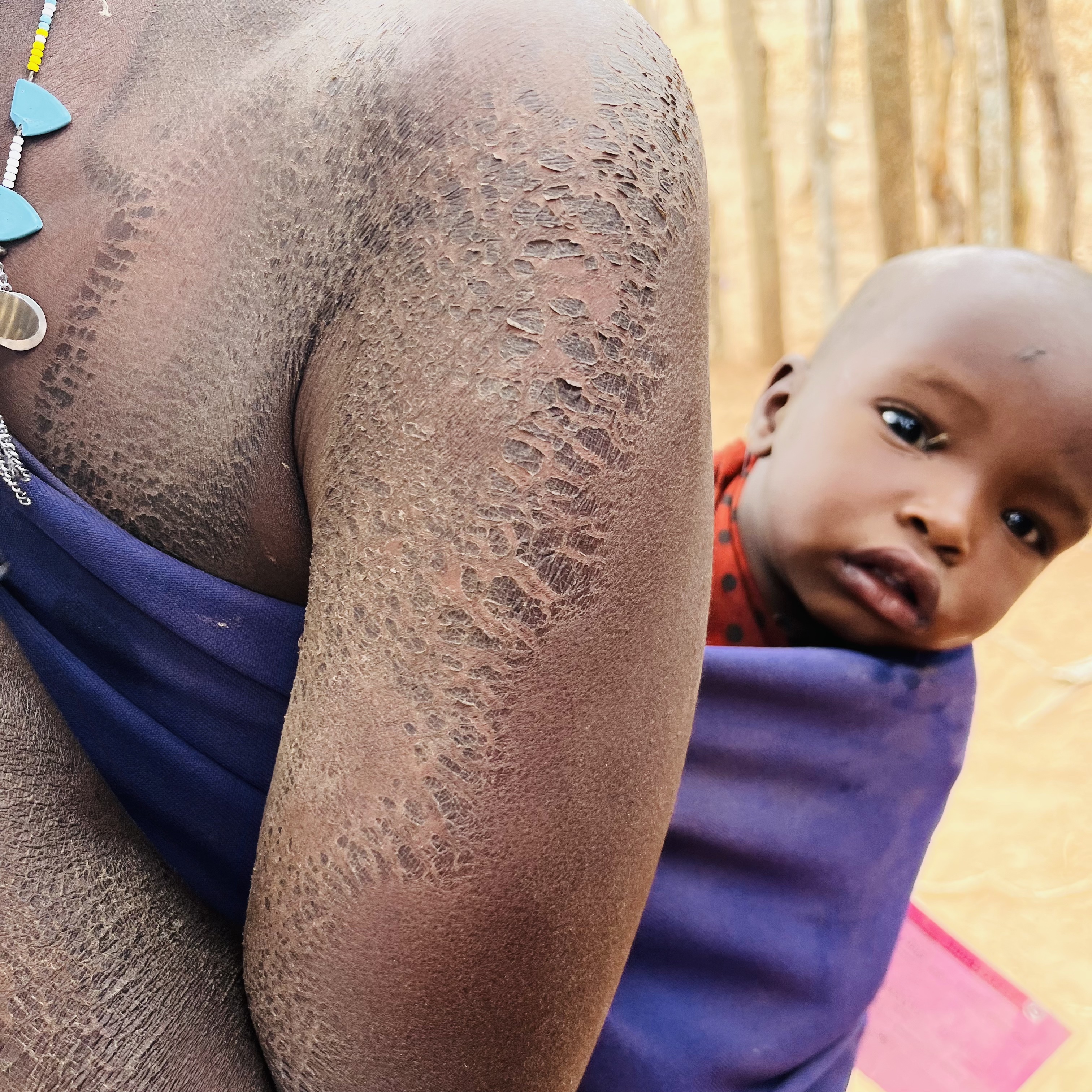 Świąteczna zbiórka na lekarzy dla dzieci w wiosce masajskiej Oltotoi Africa Help