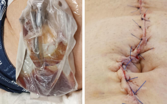 Augustyn Matuszewski