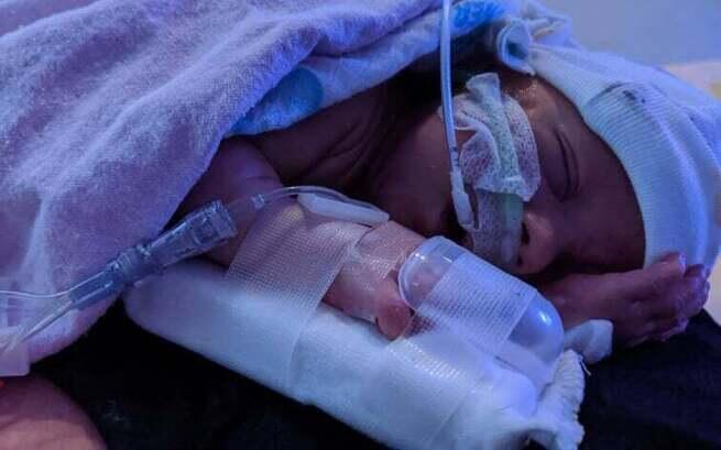 Maleńki Cud, Tylko 500 Gramów – Serca Kruszynek Biją Dzięki Tobie!