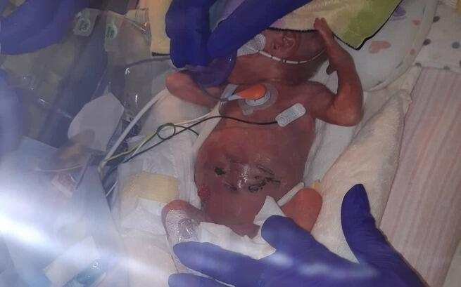 Maleńki Cud, Tylko 500 Gramów – Serca Kruszynek Biją Dzięki Tobie!