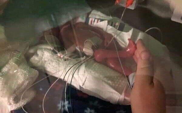 Maleńki Cud, Tylko 500 Gramów – Serca Kruszynek Biją Dzięki Tobie!