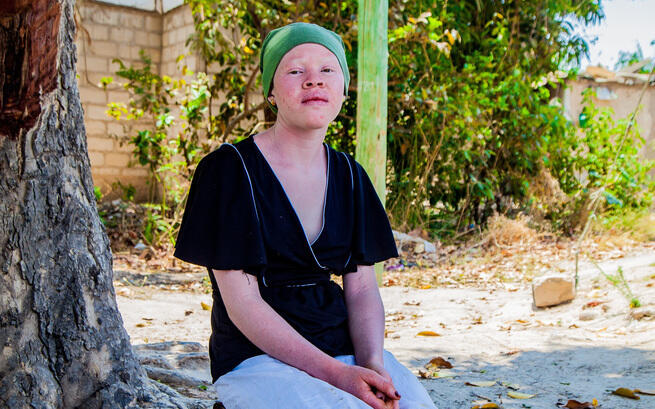 Dzieci z sierocińca chcą tylko w styczniu wrócić do szkoły! Pomóż im, bo albinizm w Tanzanii to zagrożenie dla życia. Fundacja ADRA Polska