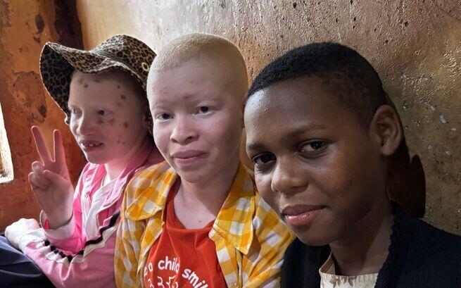 Dzieci z sierocińca chcą tylko w styczniu wrócić do szkoły! Pomóż im, bo albinizm w Tanzanii to zagrożenie dla życia. Fundacja ADRA Polska