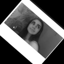 Na operację skoliozy i leczenie rehabilitacji